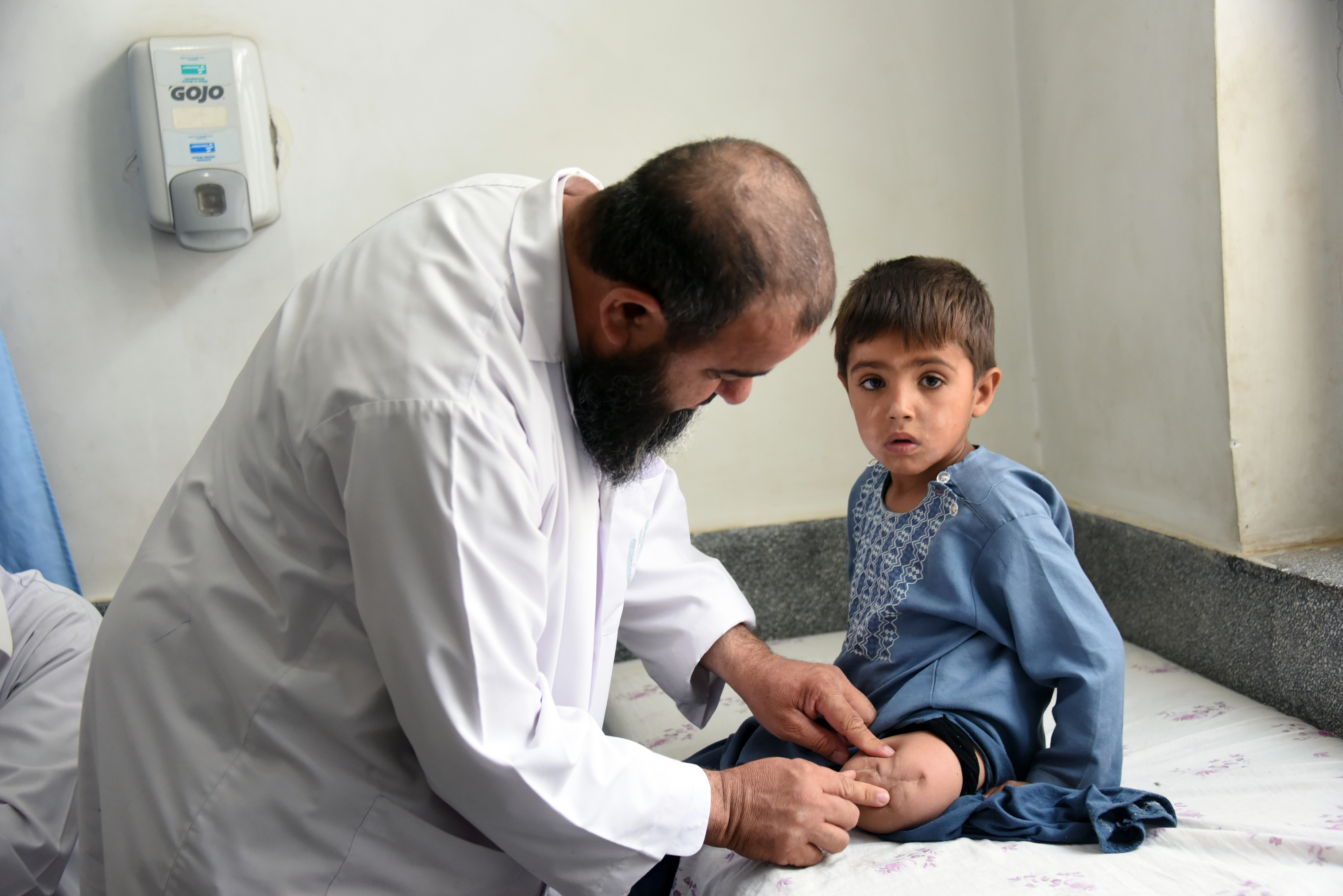 Sanaullah, 5 ans, est soigné depuis deux ans au centre de réadaptation physique de Kandahar en Afghanistan. Il a été amputé suite à un bombardement dans sa ville. 