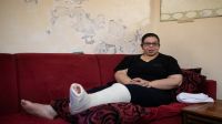 Nada Baghdadi, 27 ans, a une fracture de la jambe causée par l'explosion du port de Beyrouth le 4 août. 