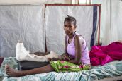 Kanyere Mwamini, fusillée chez elle, est soignée à l'hôpital de Rutshuru, au Nord Kivu. Elle bénéficie de séances de réadaptation avec HI.