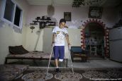 Ce jeune garçon de 11 ans a été blessé lors d’une manifestation à Gaza le 12 mai dernier.