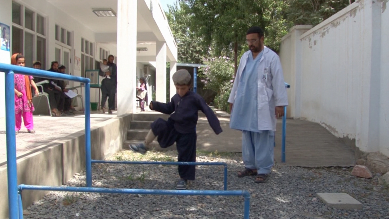 Sediqullah est suivi par Handicap International pour changer régulièrement sa prothèse