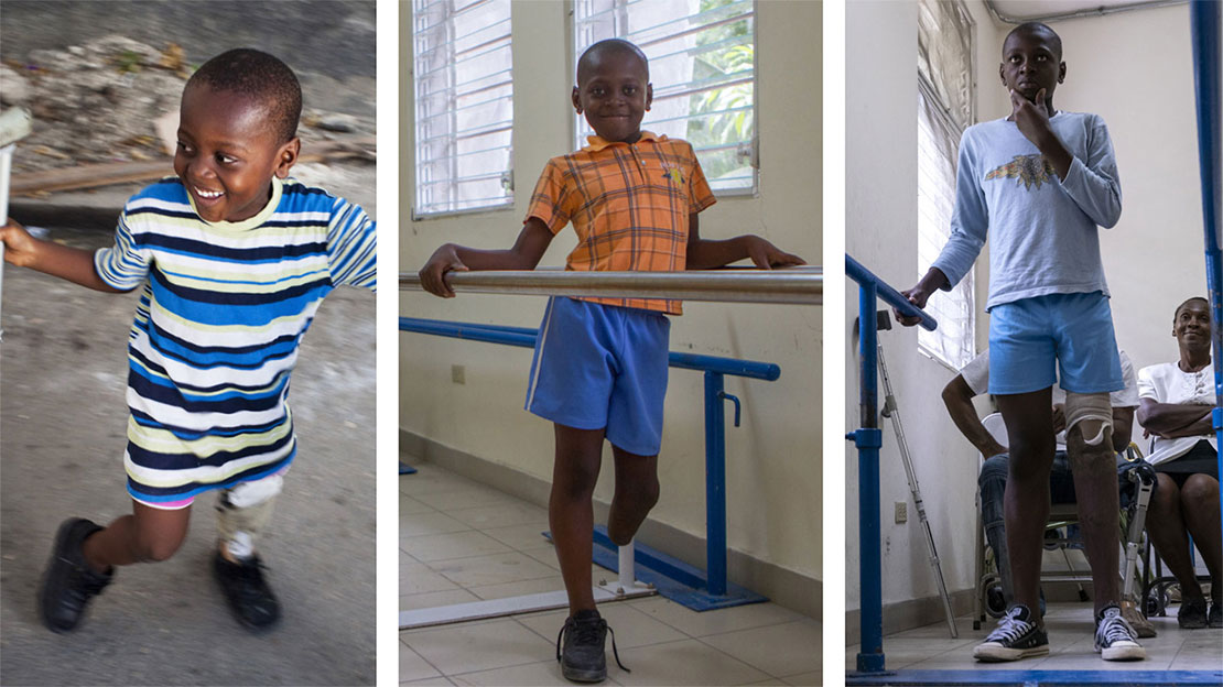 La jambe gauche de Moise (14 ans) a été amputée après le tremblement de terre de 2010, lorsque Moise avait 4 ans. Quelques mois plus tard, il a rencontré les équipes de HI et le centre de réhabilitation HHH. HI s'assure que lorsque sa prothèse devient trop petite, Moïse est équipé d'une nouvelle prothèse.
