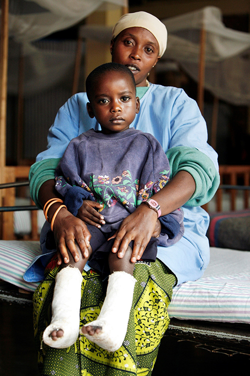 Une femme tient dans ses bras un enfant avec les pieds dans des bandages